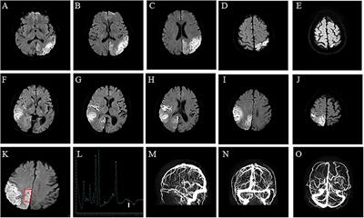 Case report: A double pathogenic mutation in a patient with late-onset MELAS/PEO overlap syndrome